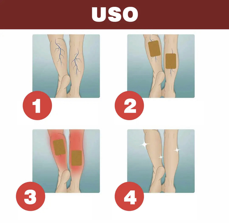 parche Varices 1324 (S 11 S75 ) 6